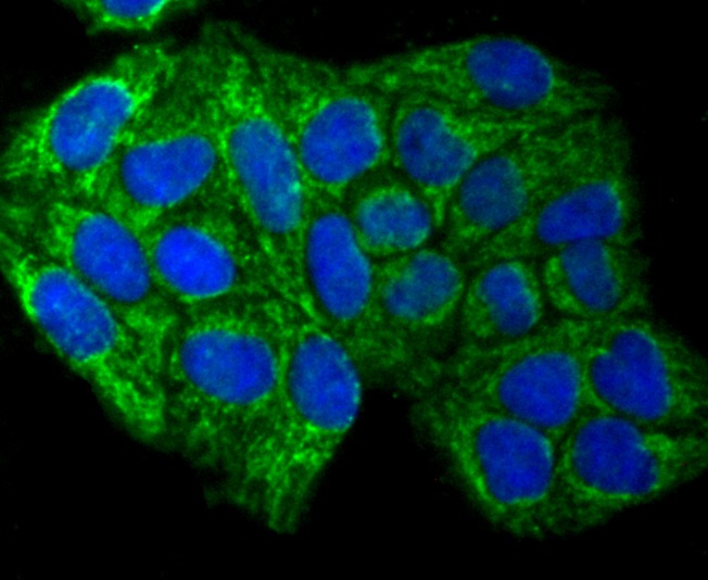 Anti-SMYD3 Antibody (2M615)
