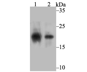 Anti-SOCS2 Antibody (9S693)
