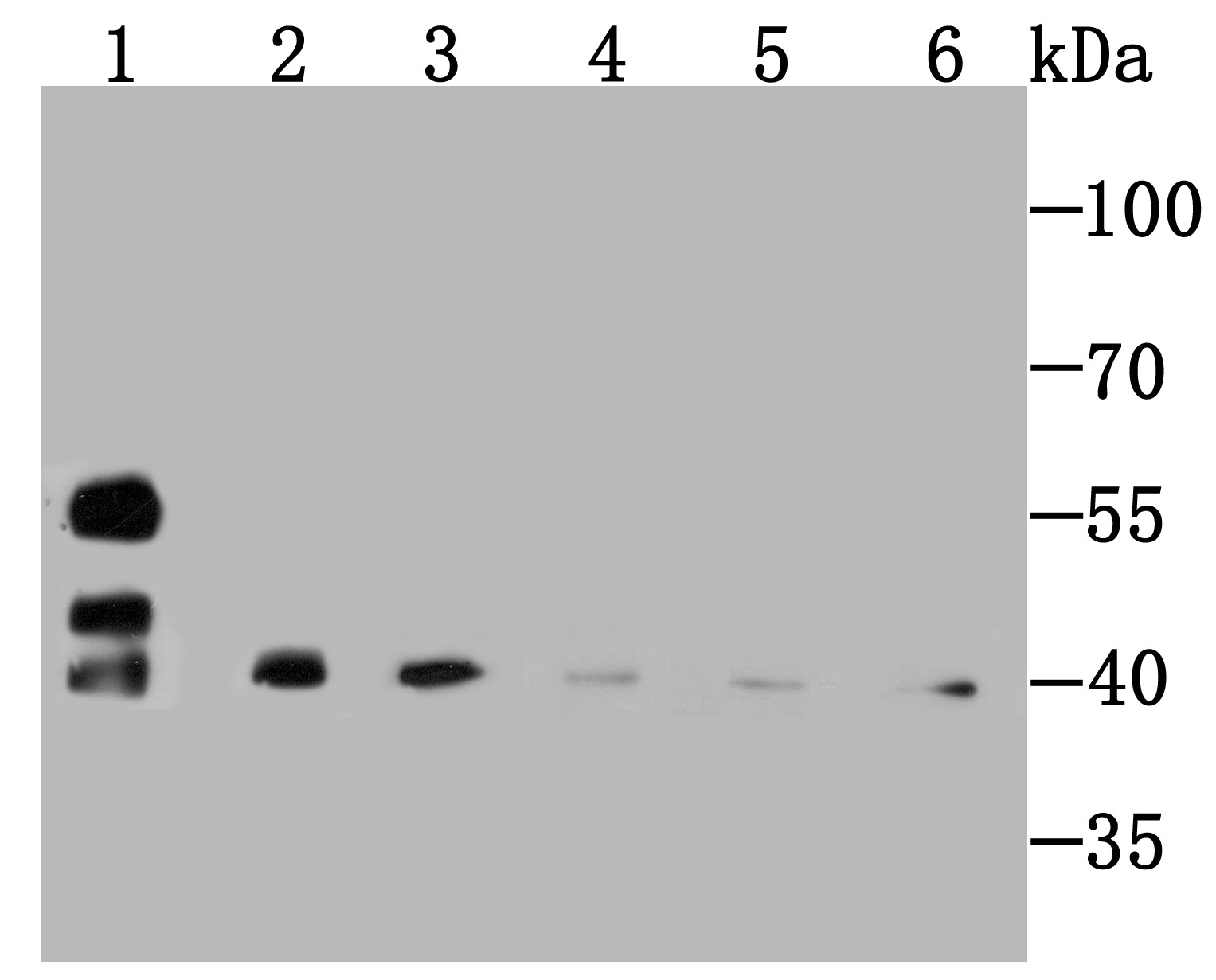 Anti-SMYD3 Antibody (2M615)