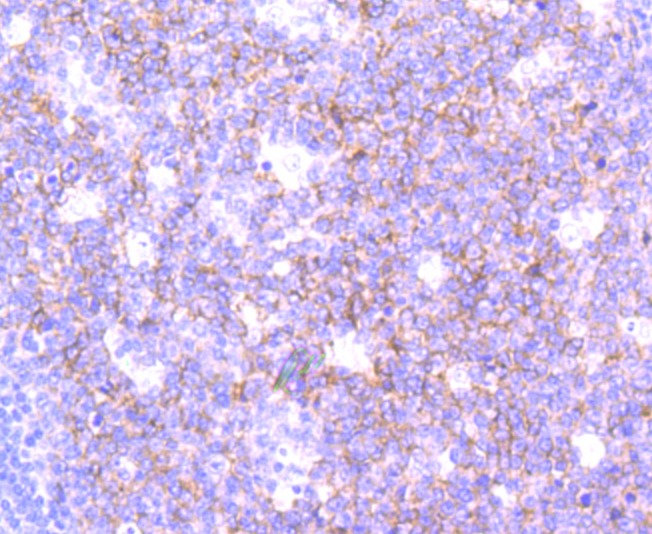 Anti-SNAP23 Antibody (7J889)