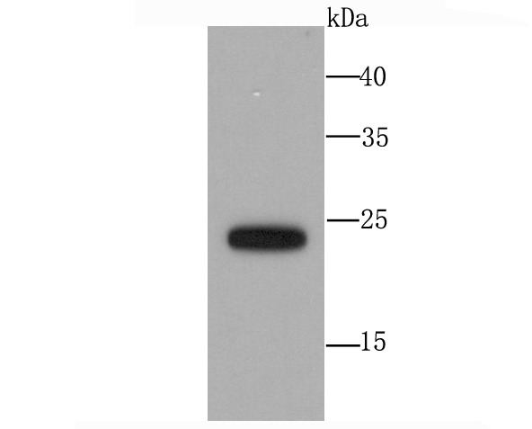 Anti-SNAP23 Antibody (7J889)
