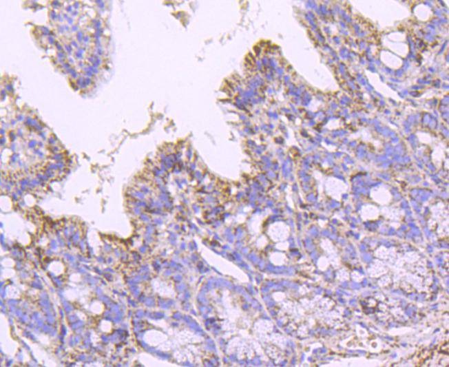 Anti-SOD2 Antibody (1Y900)