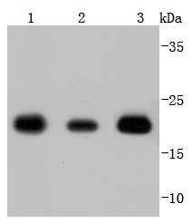 Anti-SOD2 Antibody (1Y900)