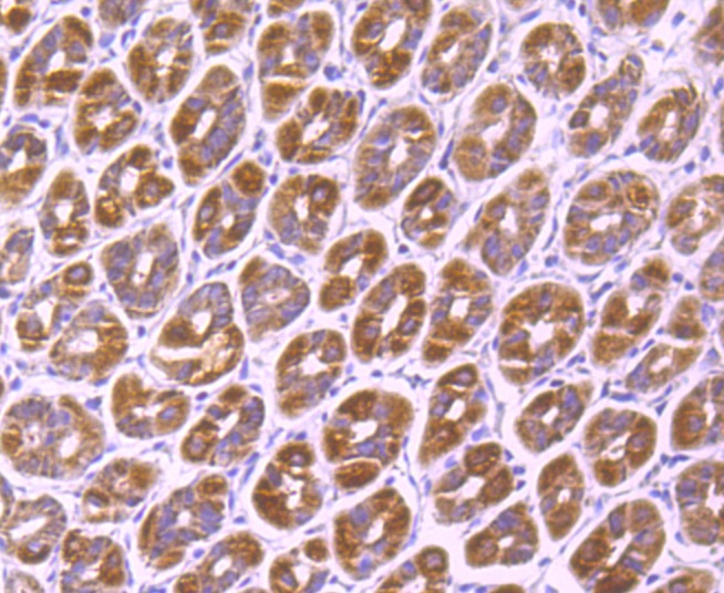 Anti-SMYD3 Antibody (2M615)