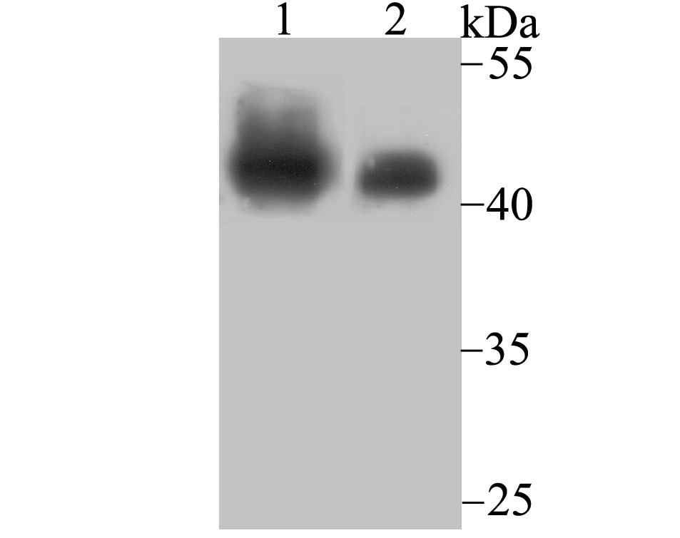Anti-SMARCB1 Antibody (3I885)