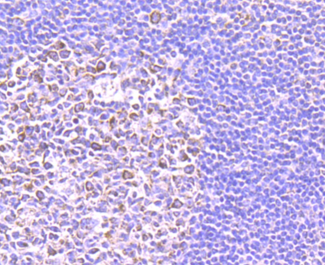 Anti-SMYD3 Antibody (2M615)