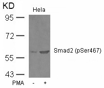Anti-Phospho-SMAD2 (Ser467) Polyclonal Antibody