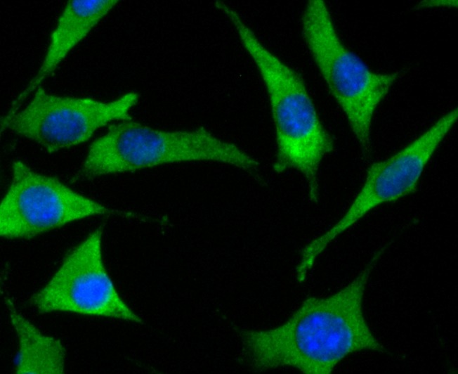 Anti-SOCS2 Antibody (9S693)