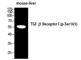 Anti-Phospho-TGFβ RI (Ser165) Polyclonal Antibody