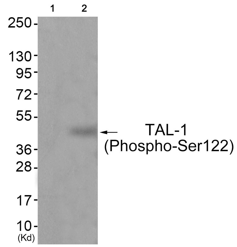 Anti-Phospho-TAL-1 (Ser122) Polyclonal Antibody