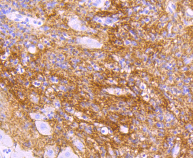 Anti-TGFBI Antibody (7P792)