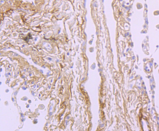 Anti-TGFBI Antibody (7P792)