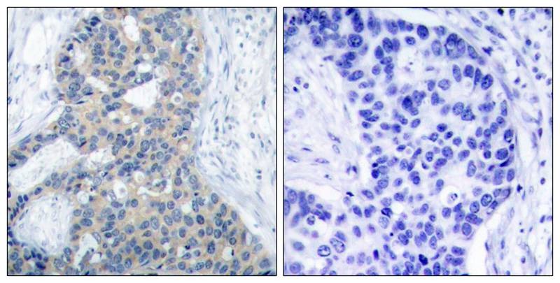 Anti-Phospho-Stathmin 1 (Ser38) Polyclonal Antibody