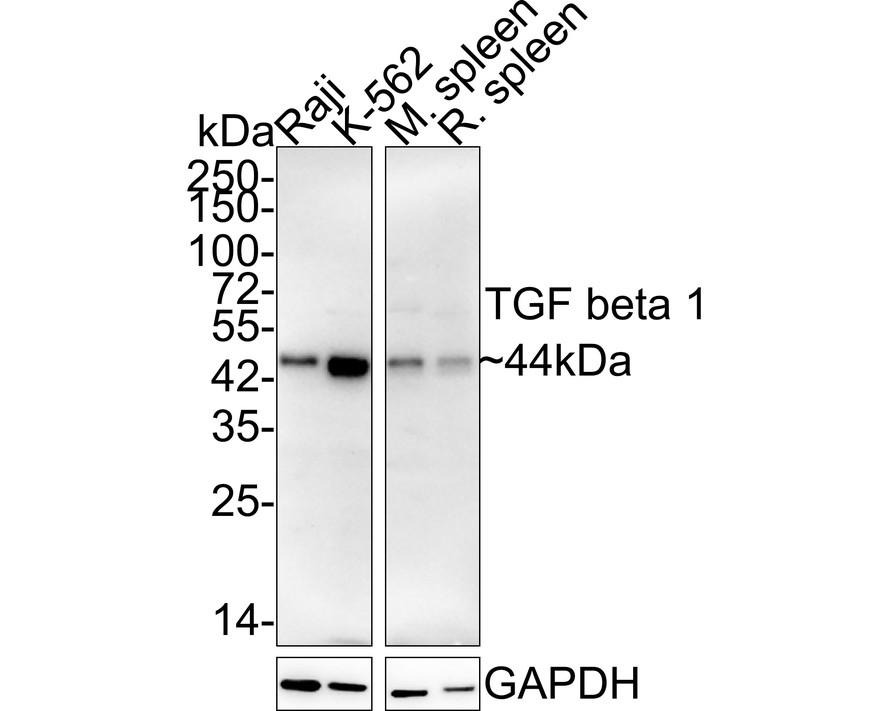 Anti-TGF beta 1 Antibody (3J953)
