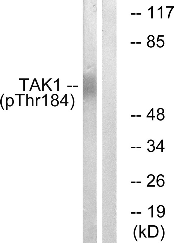 Anti-Phospho-TAK1 (Thr184) Polyclonal Antibody