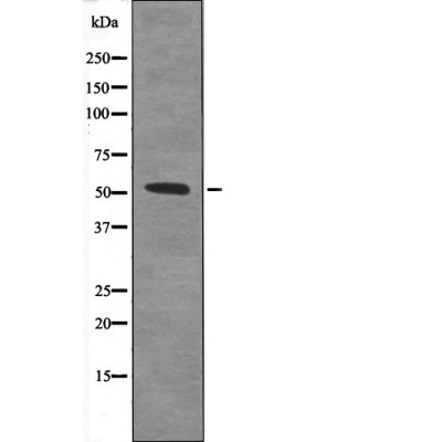 Anti-Phospho-TAB1 (Ser438) Polyclonal Antibody