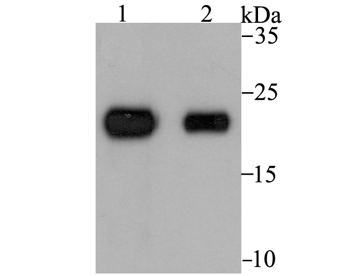 Anti-CLEC3B Antibody (6K126)
