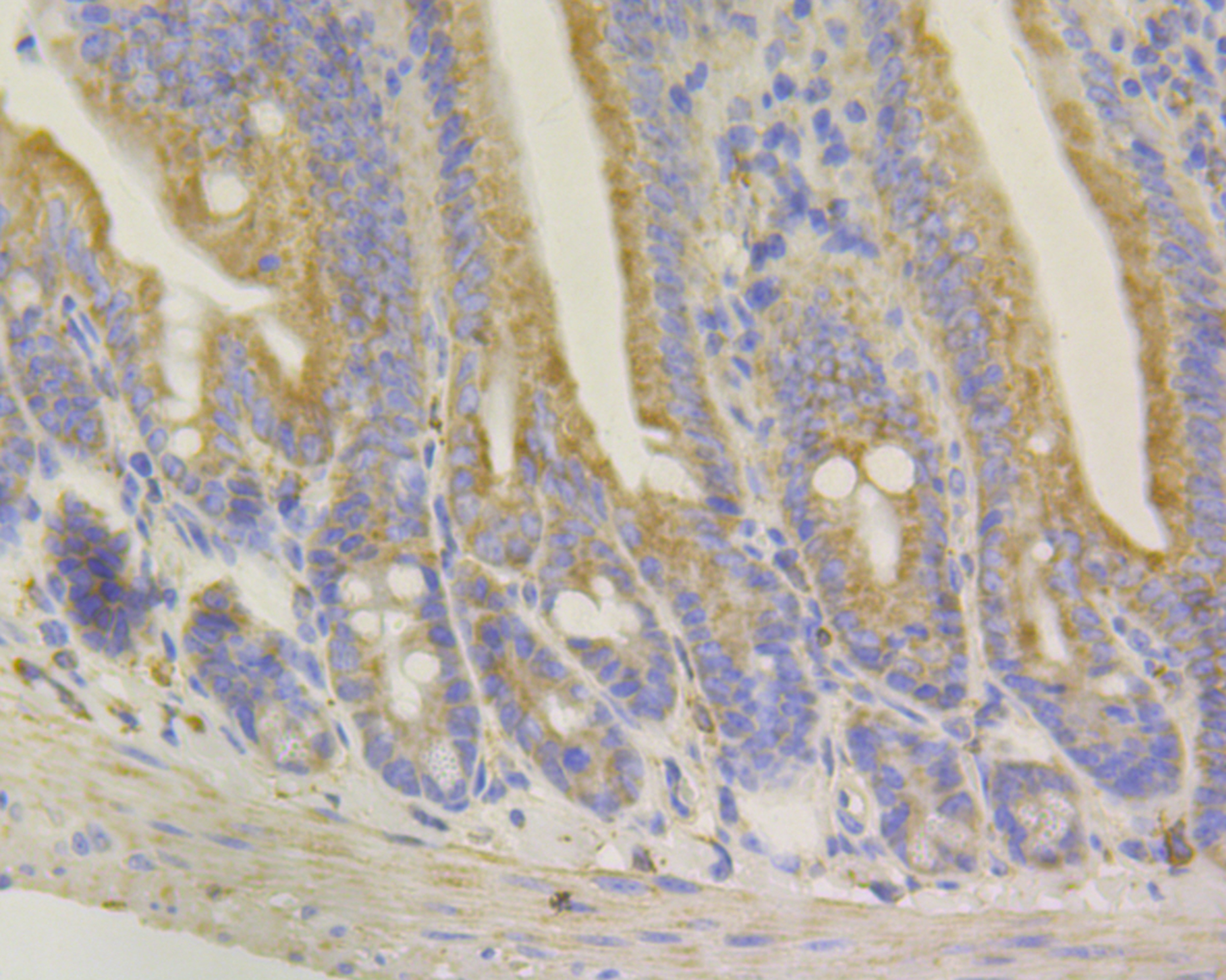Anti-Syntrophin alpha 1 Antibody (6T145)