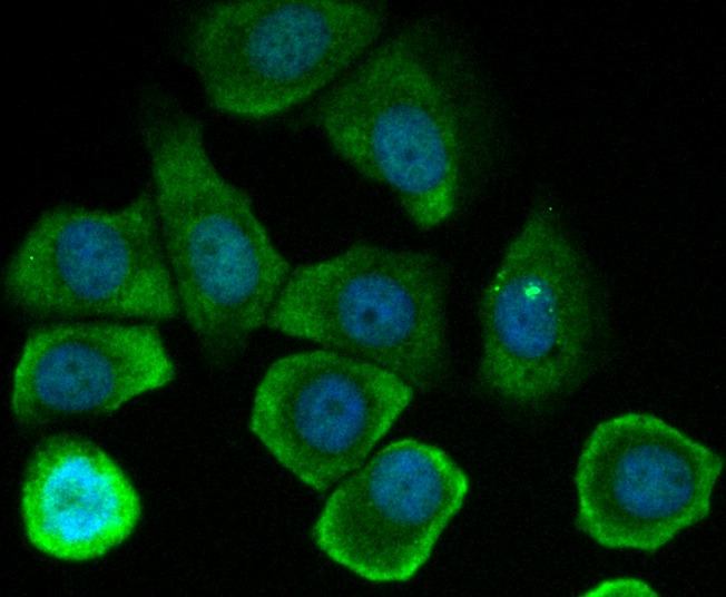 Anti-CLEC3B Antibody (6K126)