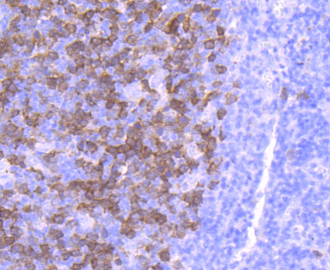 Anti-TK1 Antibody (6W861)