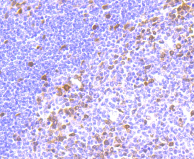 Anti-TYMS Antibody (8R369)