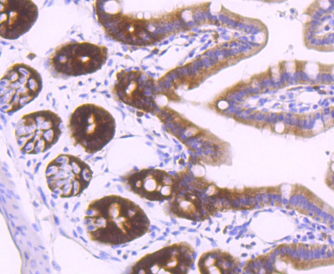 Anti-TYMS Antibody (8R369)