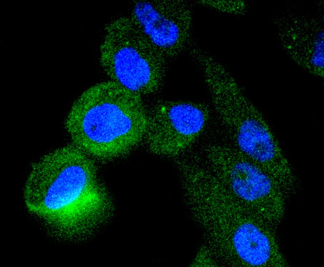 Anti-TACC3 Antibody (3B27)
