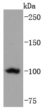 Anti-TERT Antibody (5R422)