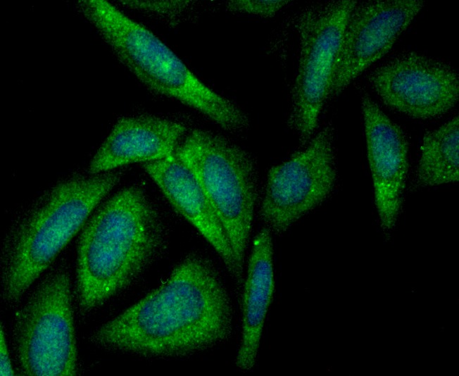 Anti-SDCBP Antibody (1Q650)
