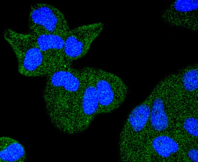 Anti-TACC3 Antibody (7N742)