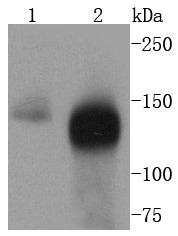 Anti-TACC3 Antibody (7N742)
