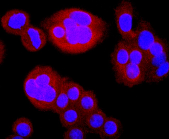 Anti-TK1 Antibody (6W861)