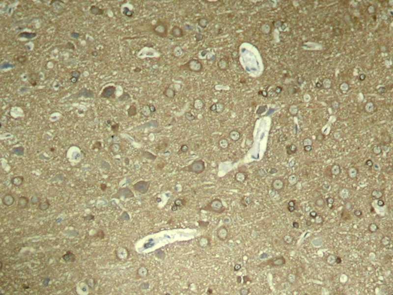 Anti-Phospho-MAPT (Ser404) Polyclonal Antibody