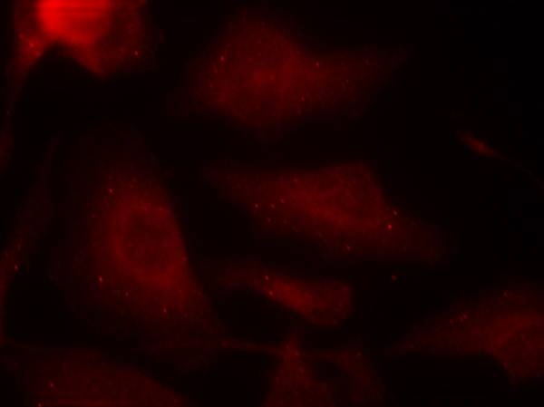Anti-Phospho-MAPT (Ser404) Polyclonal Antibody