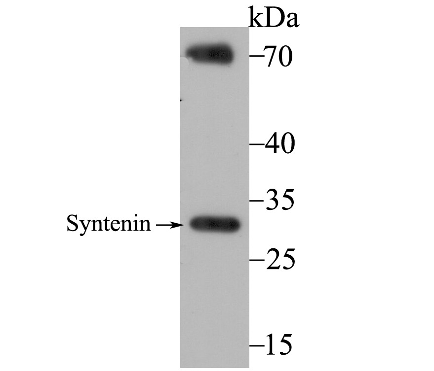 Anti-SDCBP Antibody (1Q650)