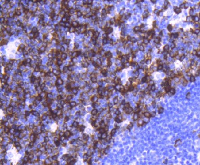 Anti-TACC3 Antibody (3B27)