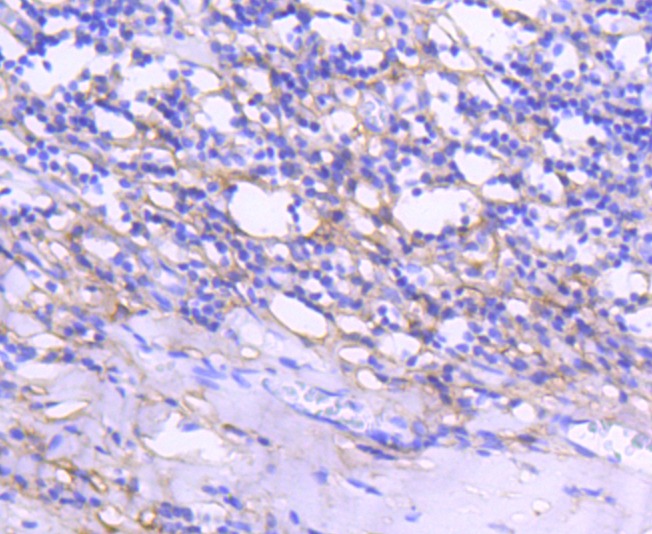 Anti-Tenascin Antibody (2I909)