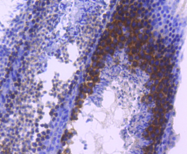 Anti-TACC3 Antibody (3B27)