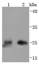 Anti-TK1 Antibody (6W861)