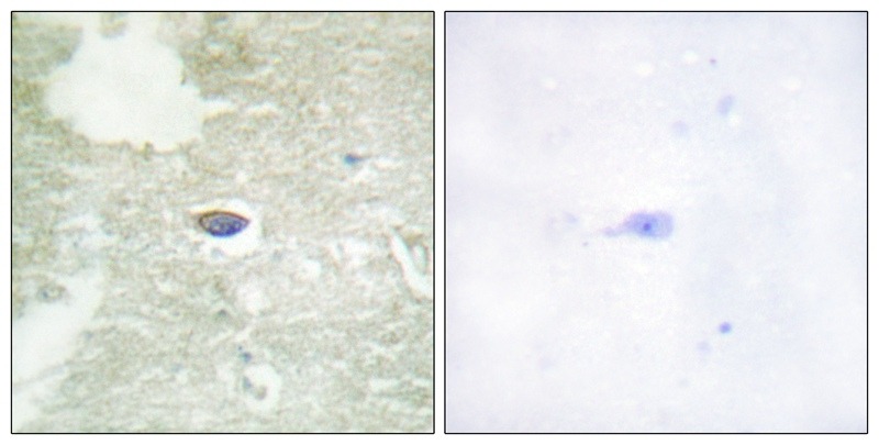 Anti-Phospho-TGFBR2 (Ser225, 250) Polyclonal Antibody