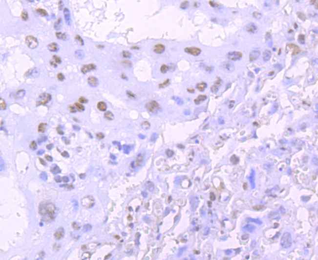 Anti-TARDBP Antibody (8Y416)