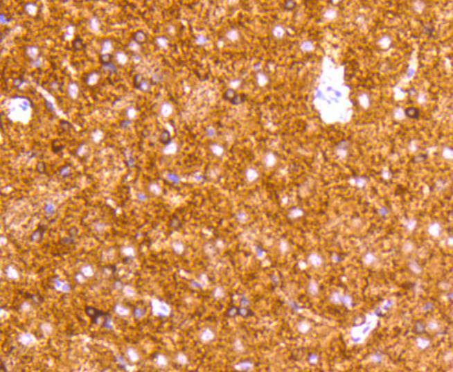Anti-MAPT Antibody (7J208)