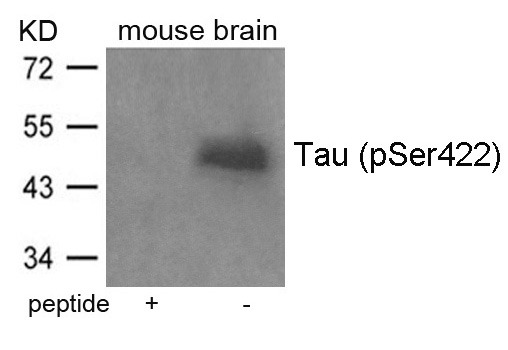 Anti-Phospho-MAPT (Ser422) Polyclonal Antibody
