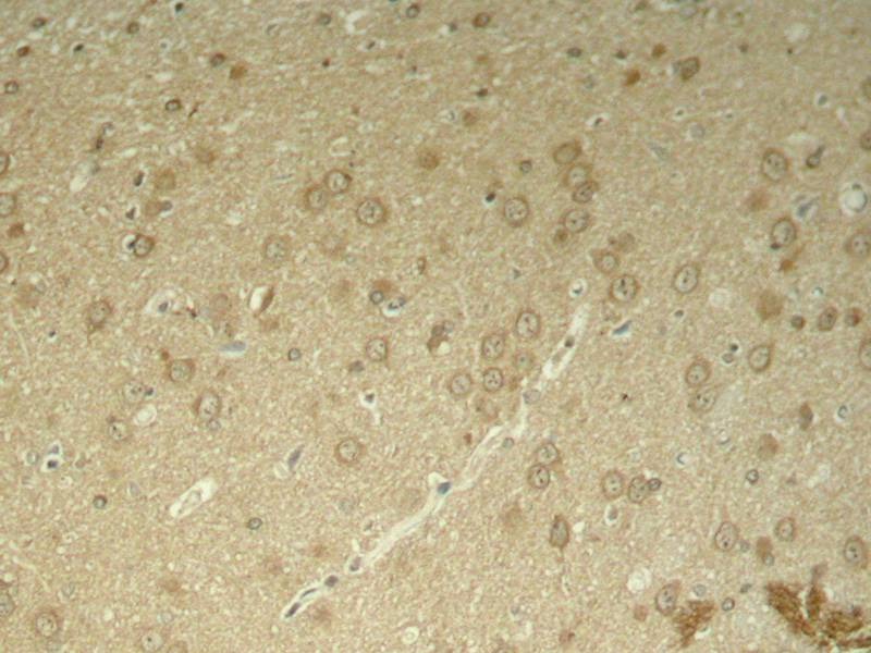 Anti-Phospho-MAPT (Thr205) Polyclonal Antibody