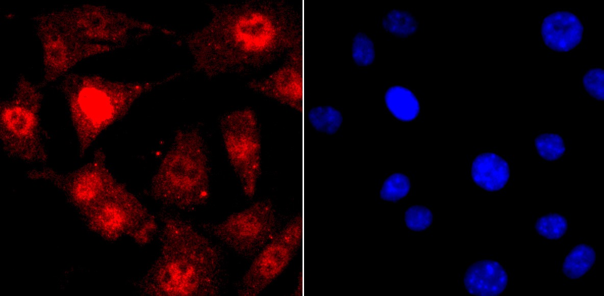 Anti-TARDBP Antibody (8Y416)