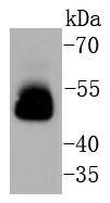Anti-MAPT Antibody (7J208)
