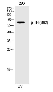 Anti-Phospho-TH (Ser62) Polyclonal Antibody