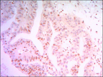 Anti-THAP11 Antibody (8P657)
