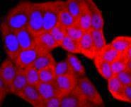 Anti-Thioredoxin/TRX Antibody (5F422)