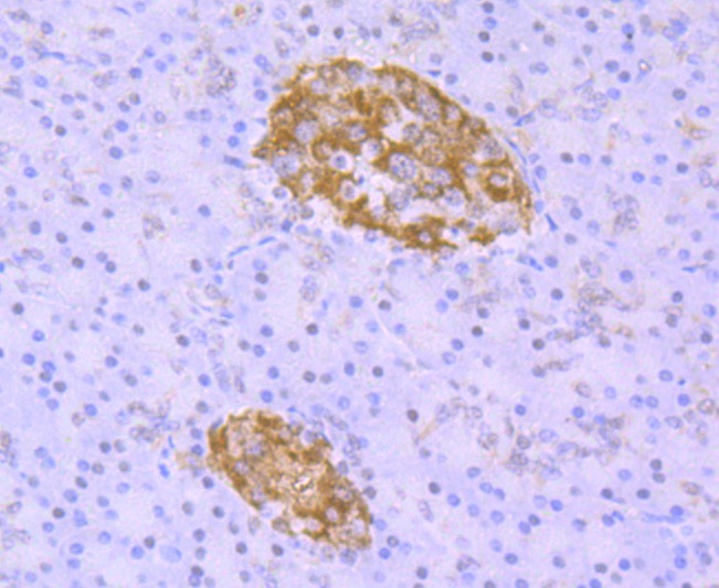 Anti-TARDBP Antibody (8Y416)